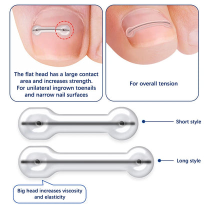2-Piece Ingrown Toenail Correction Kit – Elastic Patch & Straightening Clip Pedicure Tool for Toe Nail Treatment
