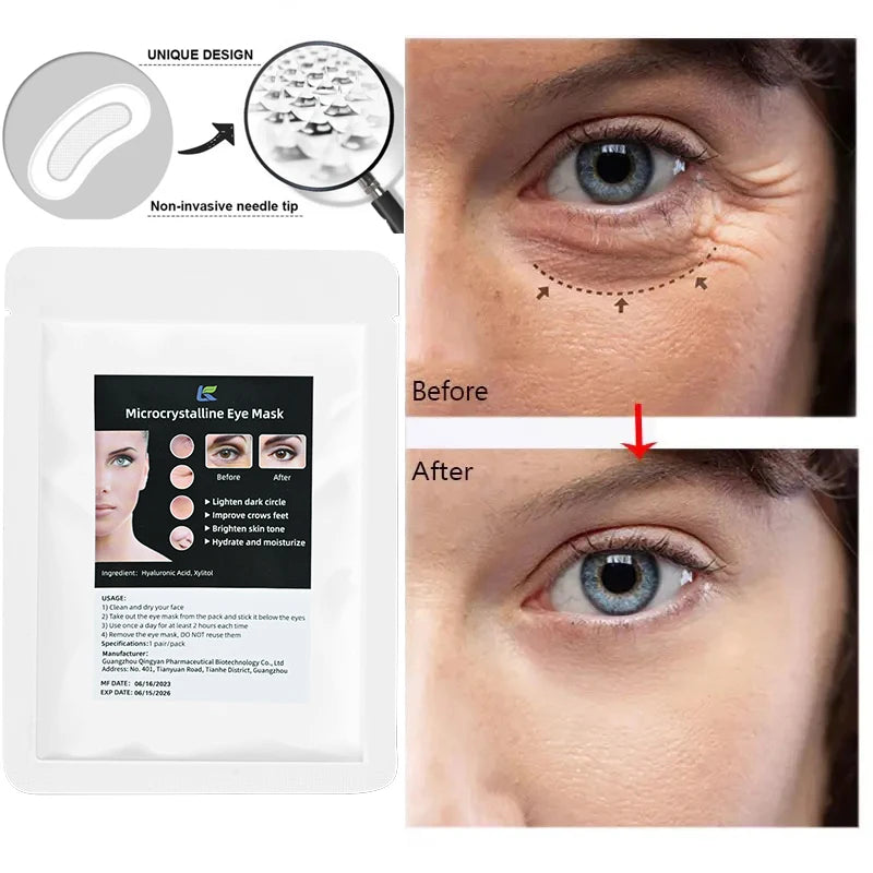 Micro-Needle Hyaluronic Acid Eye Patch – Anti-Wrinkle Moisturizing Eye Mask for Fine Lines Removal