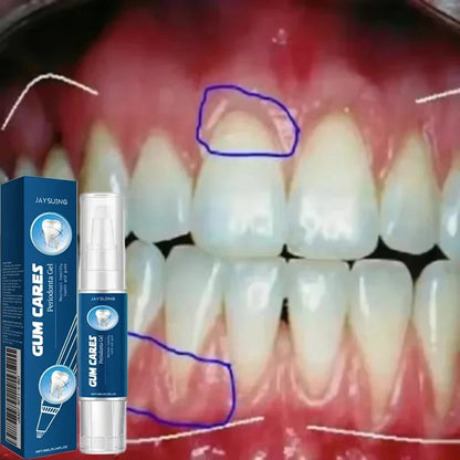 Gum Repair Care Gel | Sore Gums Relief & Deep Teeth Cleaning Serum for Stains, Tartar & Dental Health