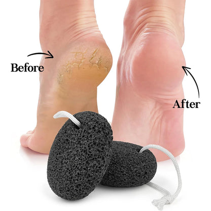 Natural Lava Pumice Stone Callus Remover — Foot, Heel & Palm Exfoliating Scrubber for Hard Skin Care