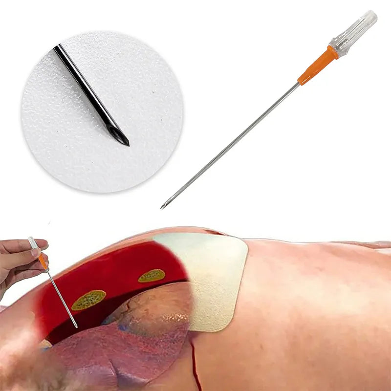 Emergency First Aid Kit - Tension Pneumothorax Thoracic Needle, Medical Chest Decompression Needle for Emergency Equipment