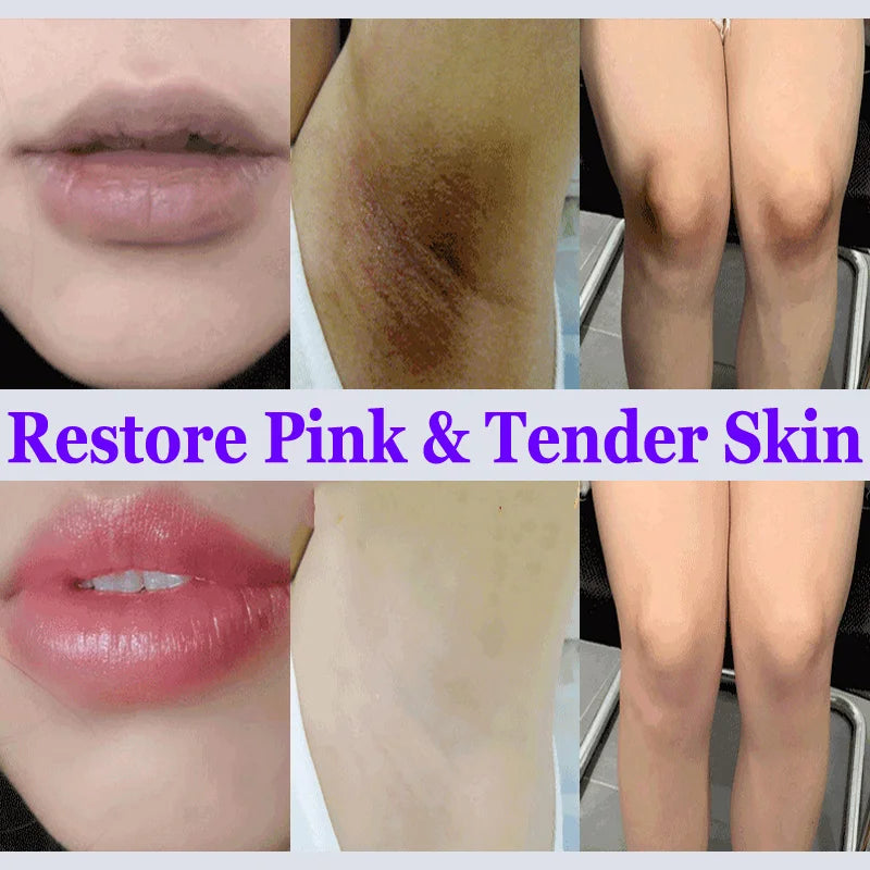 Whitening Cream for Private Parts – Underarm, Inner Thigh & Knee Brightening Serum