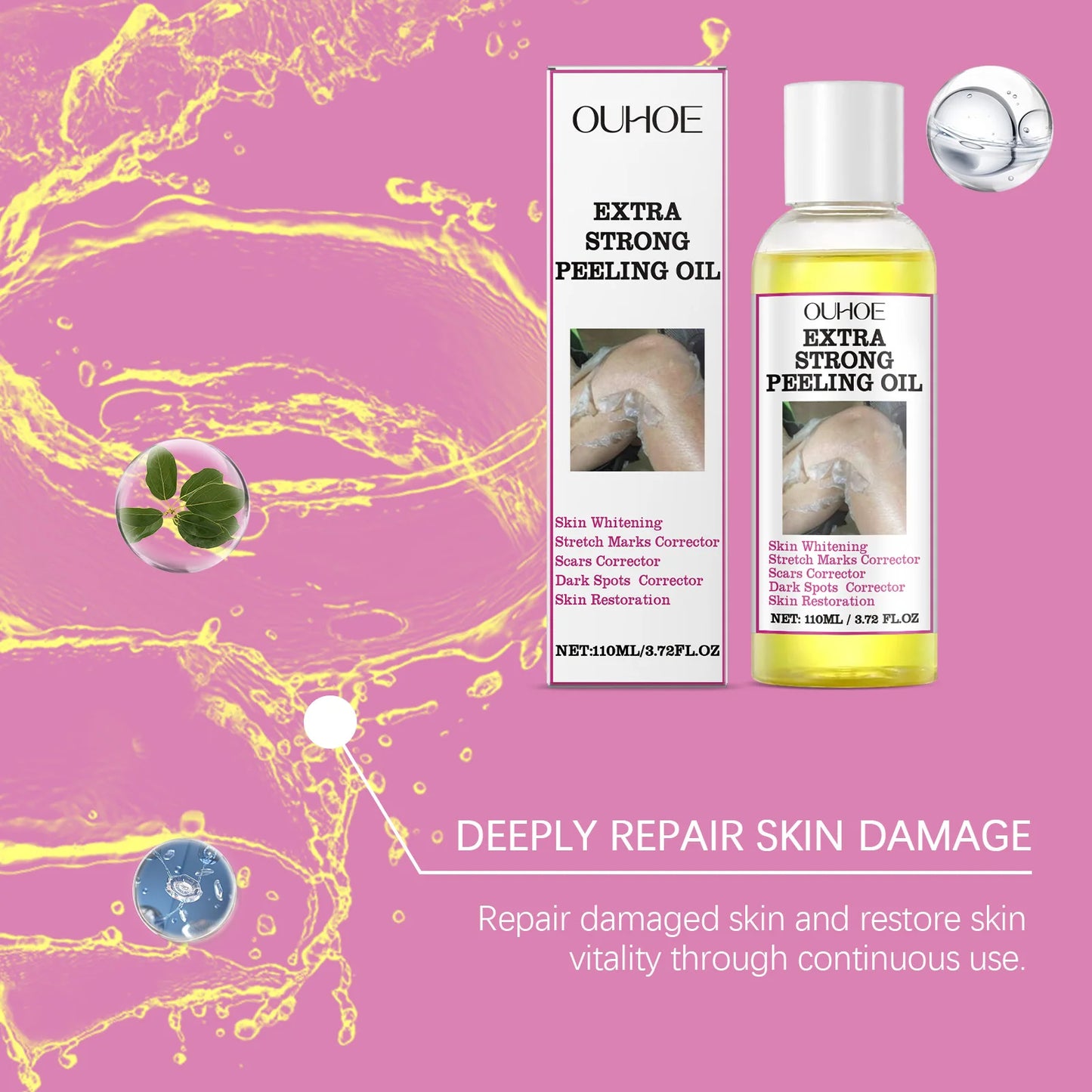 30/110ml Super Strength Body Peeling Oil — Brightening, Moisturizing & Exfoliating Skin Care Oil