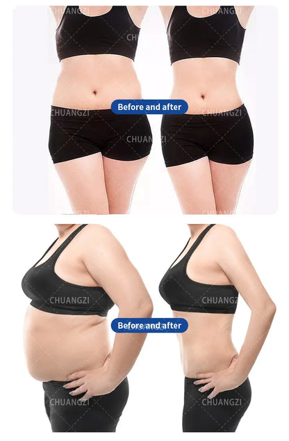EMSzero Sculpting Machine – Portable NEO Body Slimming, Nova RF & EMS Electromagnetic Muscle Stimulator for Professional Use
