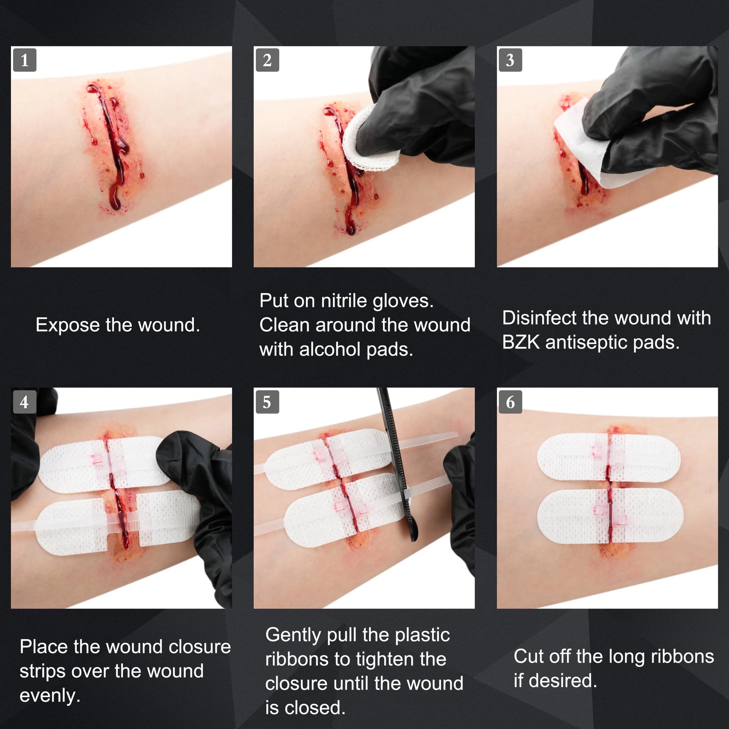 RHINO RESCUE Zip Stitch Wound Closure Kit – Dressings & Strips for Cut Care