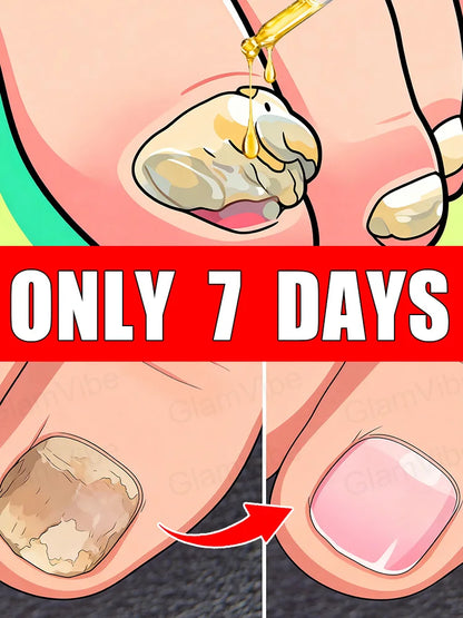 Quick Fungal Nail Treatment — Fast-Acting Solution to Say Goodbye to Nail Fungal Worries