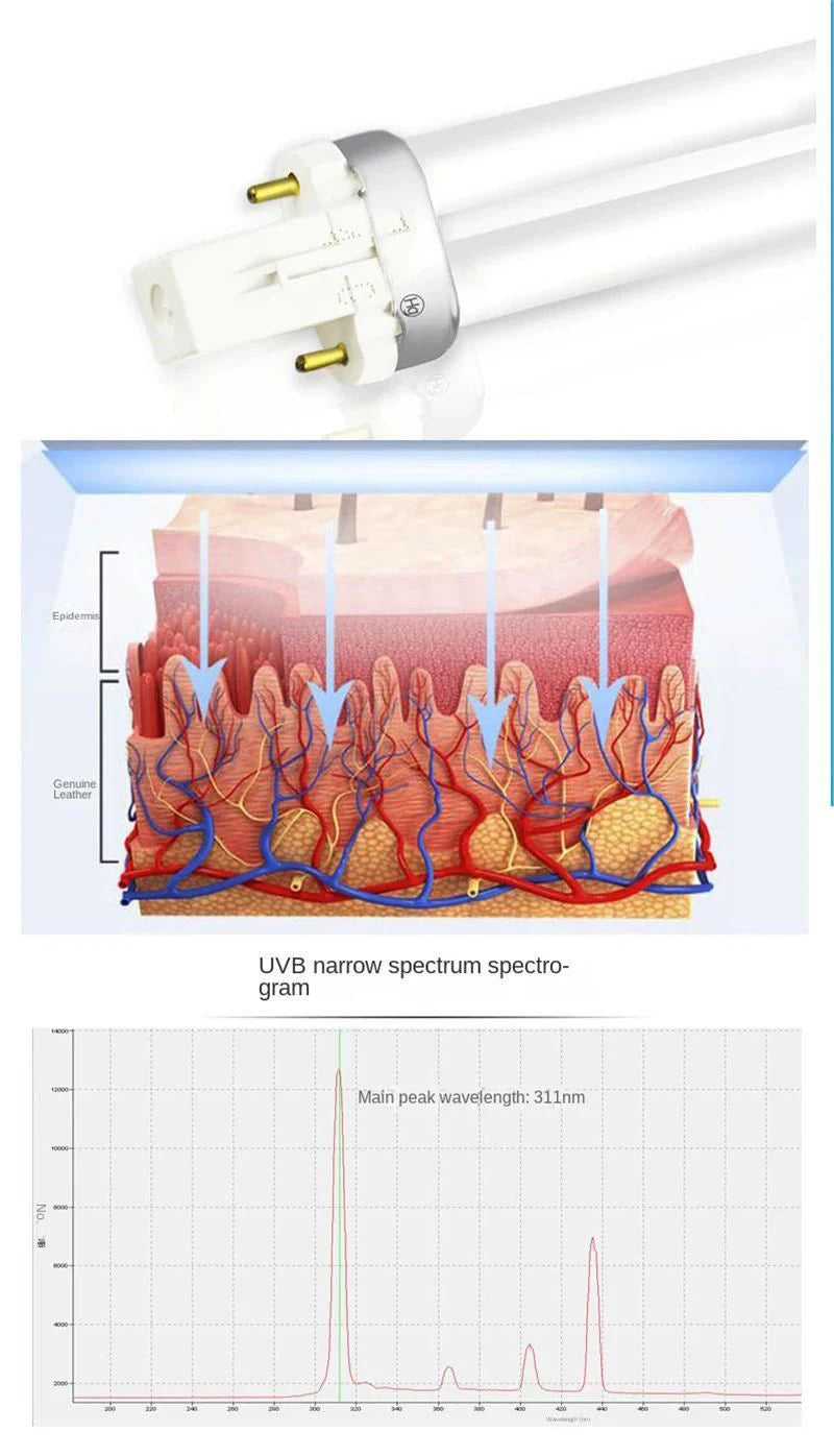 UV 311nm Phototherapy Device – Philips UVB Lamp for Vitiligo, Psoriasis & Skin Treatment