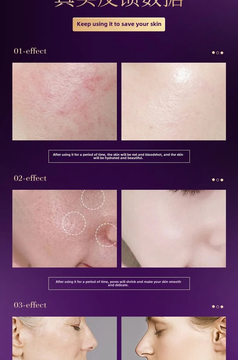Niacinamide Peptide Ampoule Serum – Anti-Aging, Pore Shrink & Deep Moisturizing Facial Essence