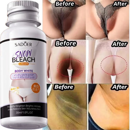 Whitening Cream for Private Parts – Underarm, Inner Thigh & Knee Brightening Serum
