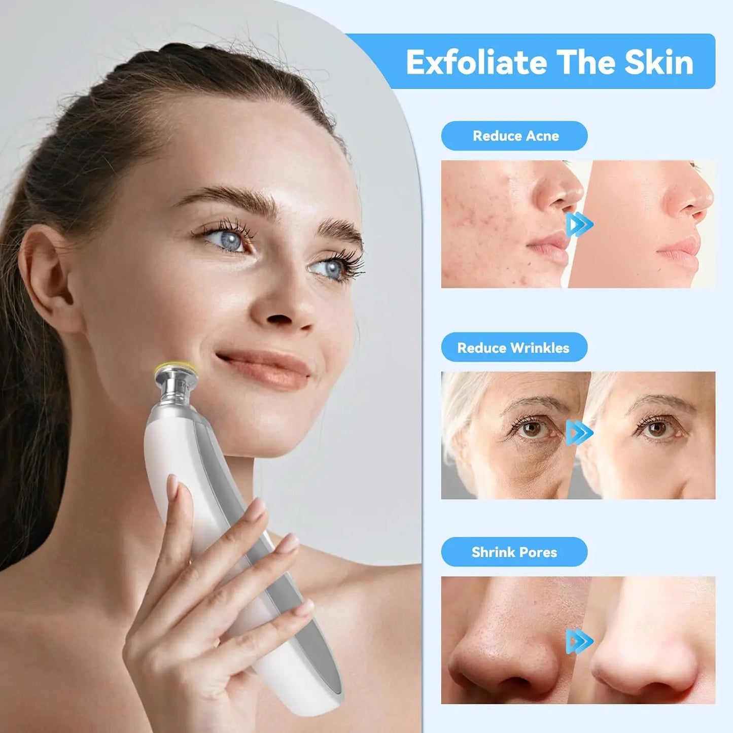 Upgraded Diamond Microdermabrasion Machine - Blackhead Removal & Professional Facial Deep Cleansing Device for Home Skin Care