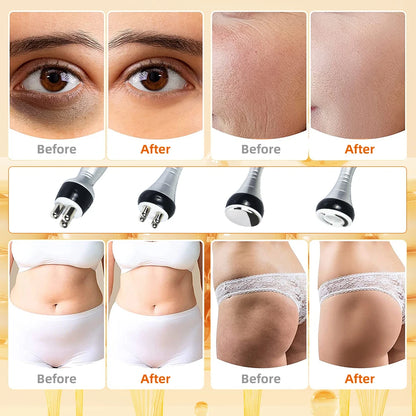 40K 4-in-1 Cavitation Body Slimming Machine – Face Lifting, Skin Tightening & Vacuum Massager with Gel (Fast Shipping)