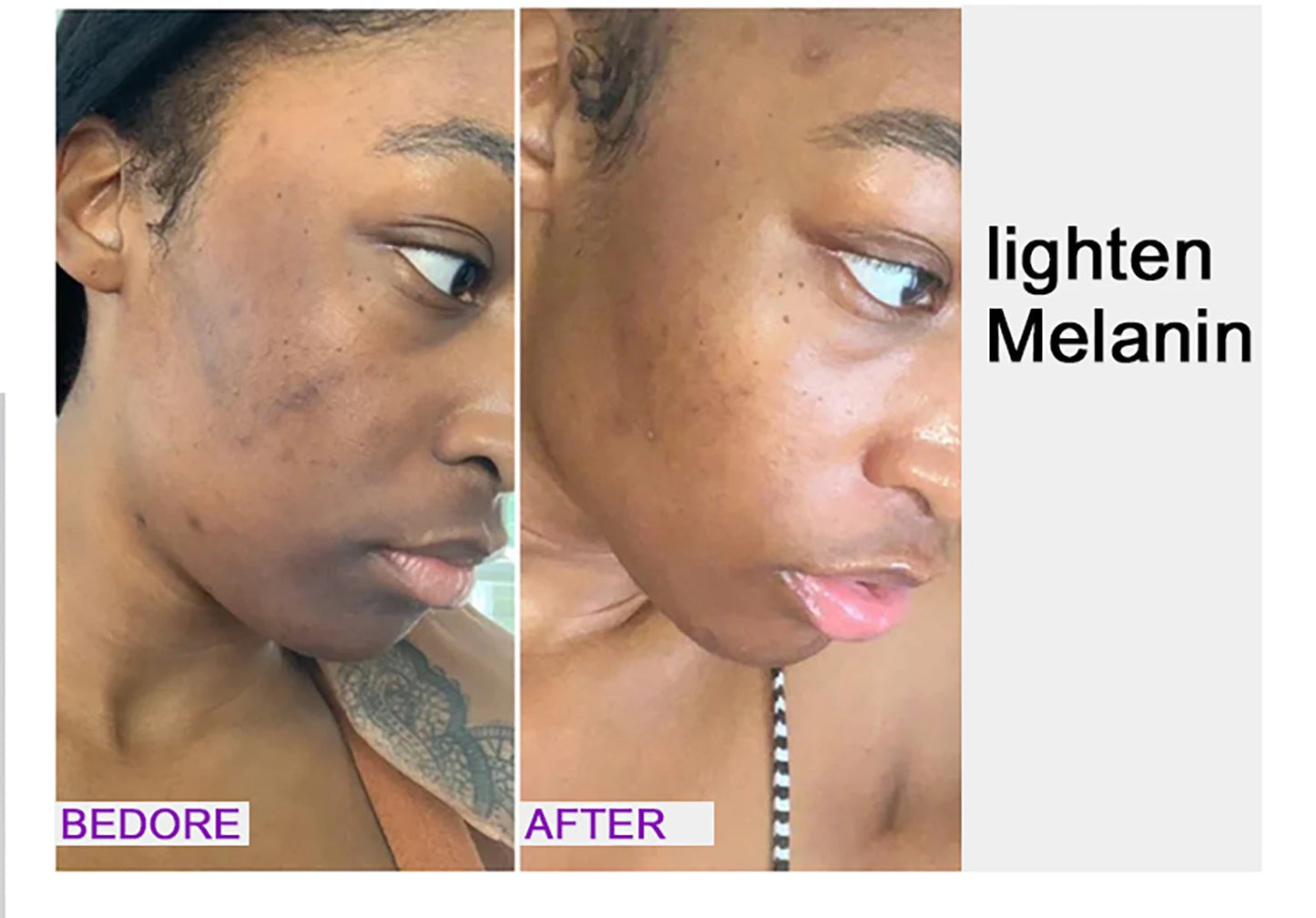 AILKE Glutathione Lightening Body Lotion – Moisturizing & Hydrating for Even Skin Tone and Dark Spot Improvement