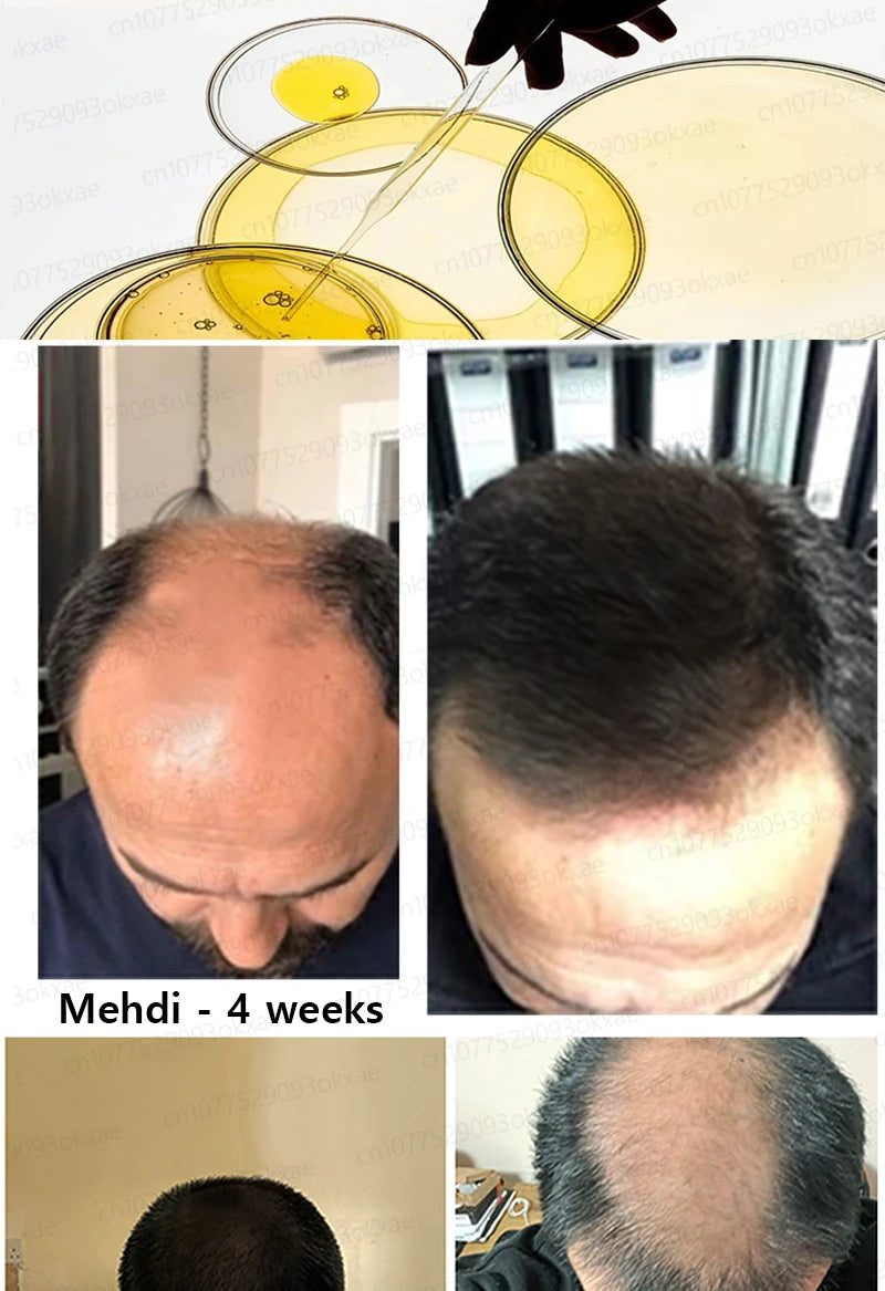 WPRBREGT Blue Hair Growth Serum — Essential Oil for Thicker Hair, Anti-Baldness Treatment