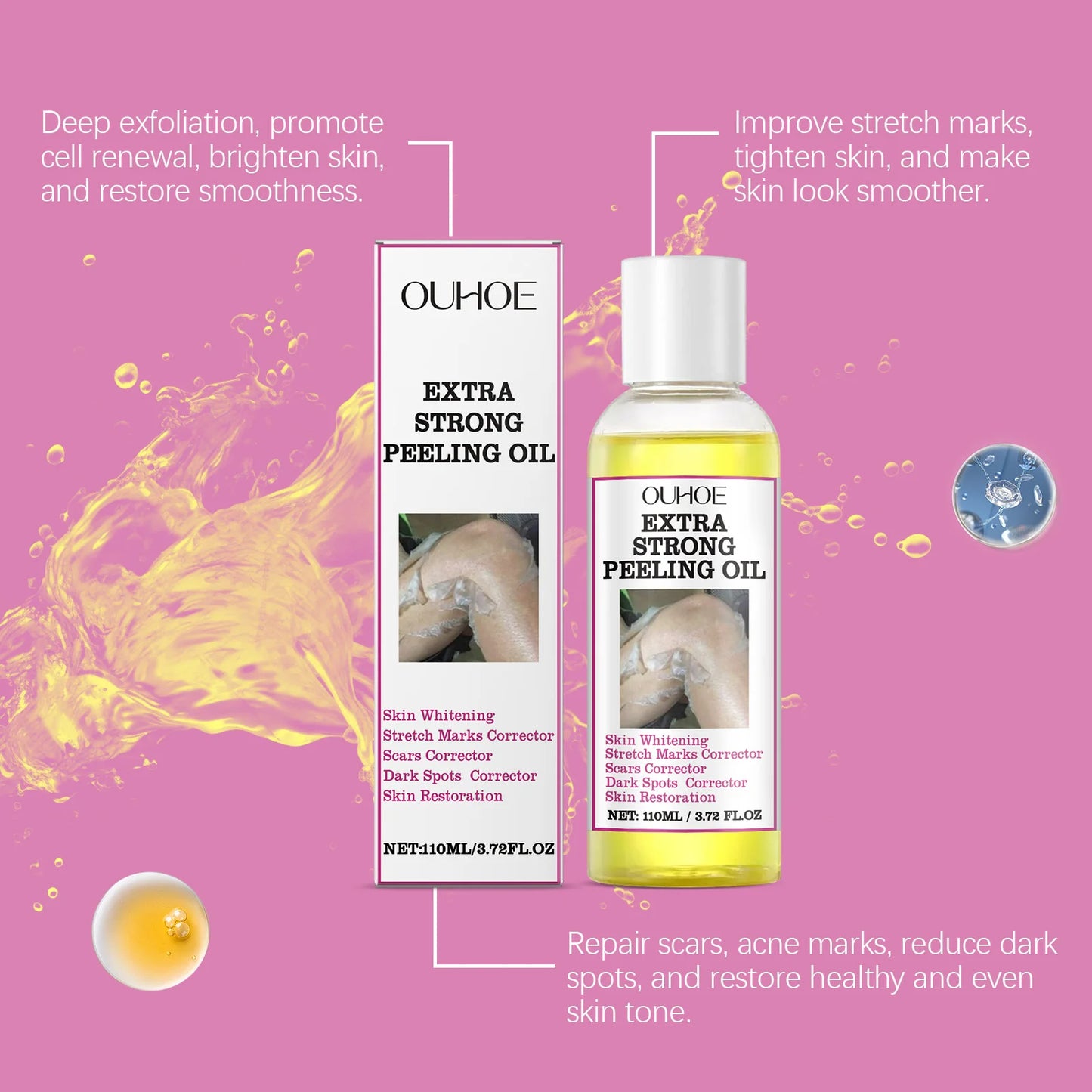 30/110ml Super Strength Yellow Peeling Oil – Brightening & Exfoliating Body Oil for Even Skin Tone & Moisturizing Care