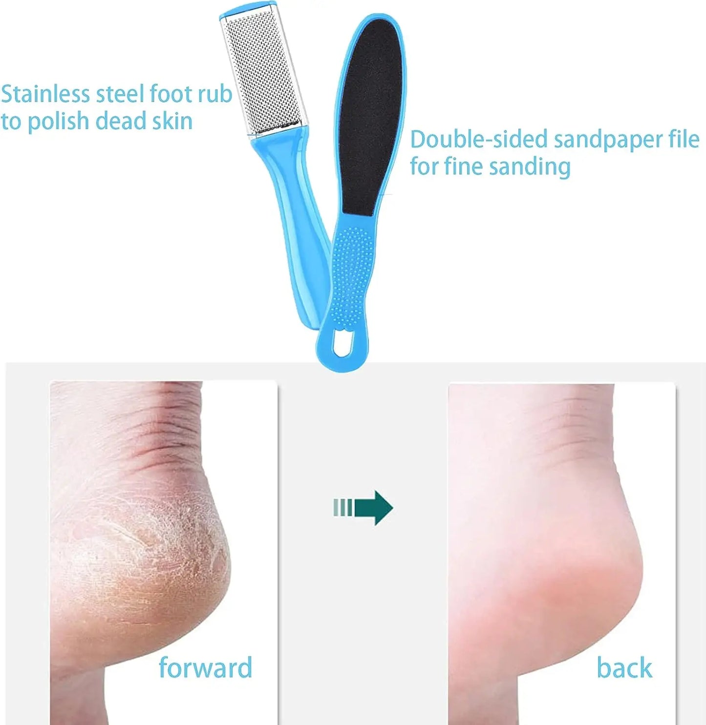 8 Piece Foot Exfoliating File Set - Octopus Fish Eye Heel Scraper for Callus Removal, Cracked Heel and Sole Care