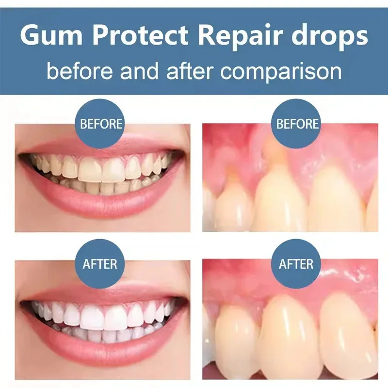 Gum Repair Care Gel | Sore Gums Relief & Deep Teeth Cleaning Serum for Stains, Tartar & Dental Health