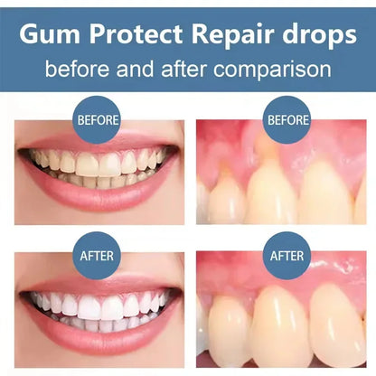 Gum Repair Care Gel | Sore Gums Relief & Deep Teeth Cleaning Serum for Stains, Tartar & Dental Health