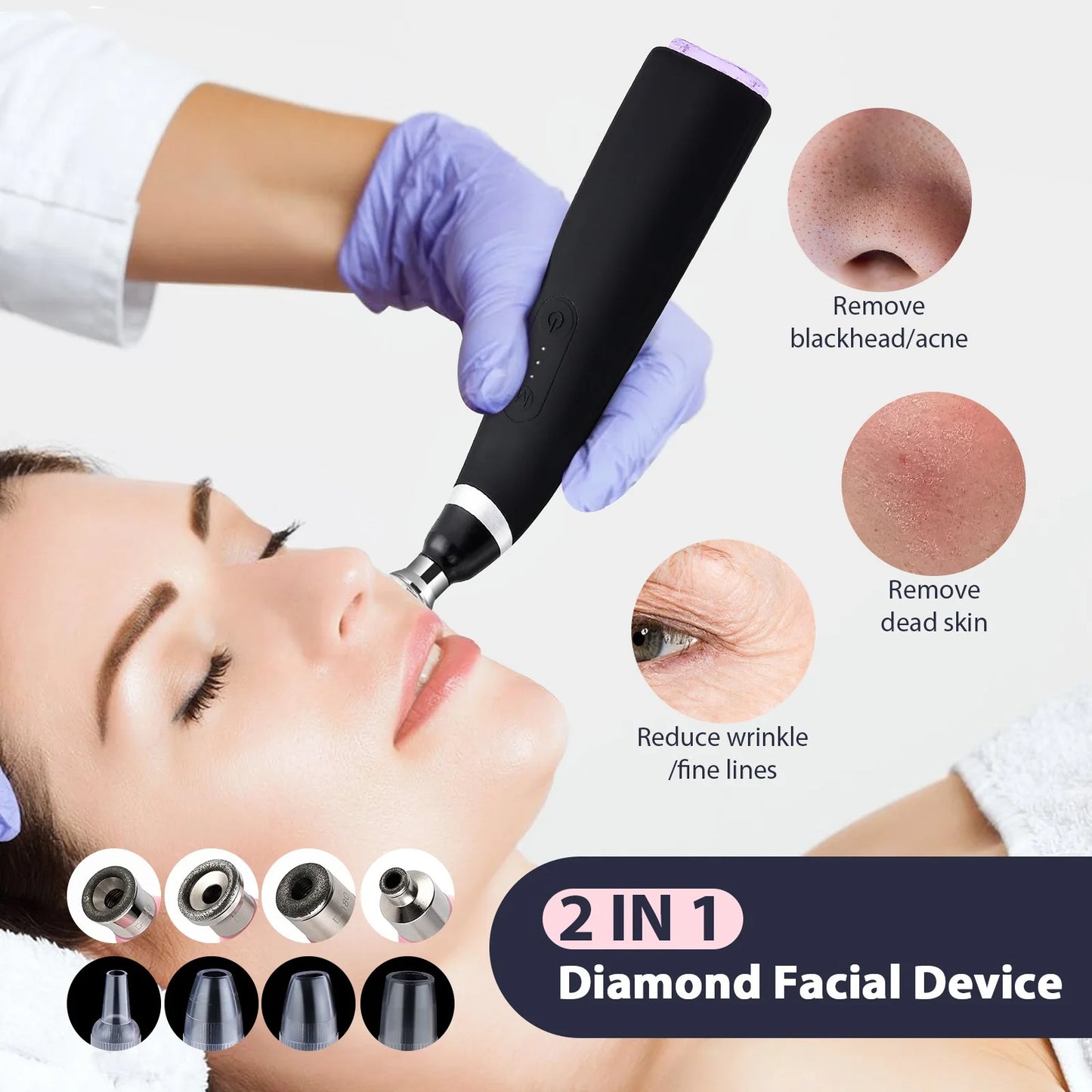 Foreverlily Portable Diamond Peeling Machine – Microdermabrasion Facial Cleaner & Blackhead Remover Vacuum Device