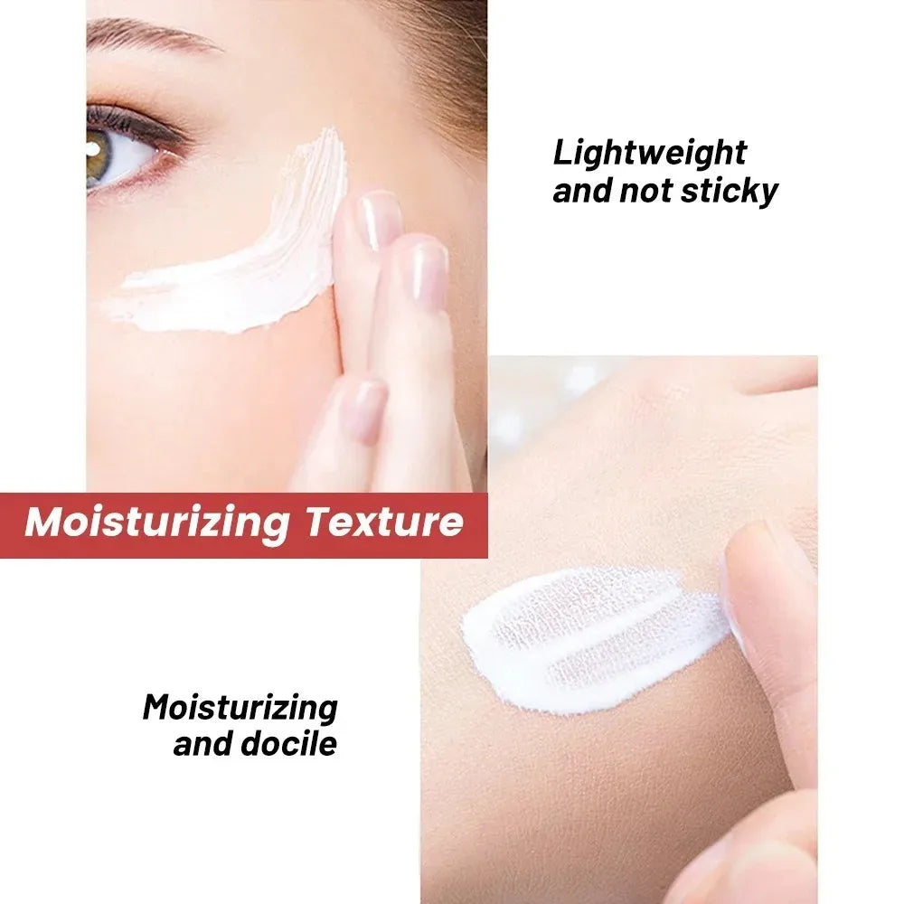 Niacinamide Whitening Freckle Cream – Anti Dark Spot, Melasma & Pigmentation Removal Anti-Aging Skin Brightening Cream (1/3/5pcs)