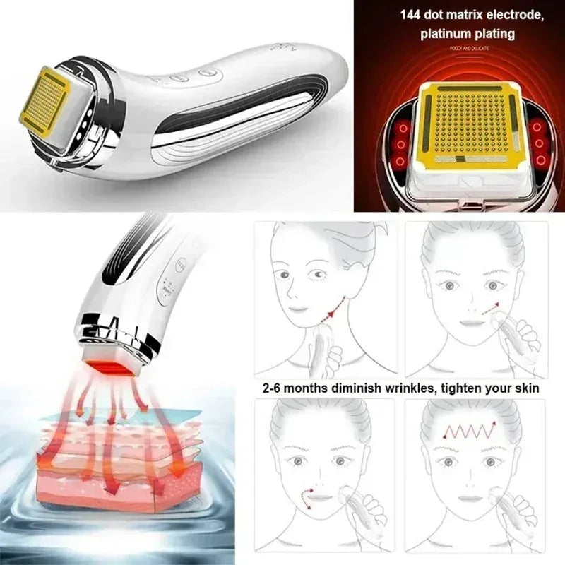 Electric Facial Lifting Machine - Dot Matrix Skin Tightening & Rejuvenation Massager