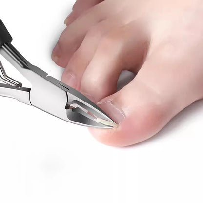 Nail Clipper Set for Ingrown Toenails — Paronychia Correction Nippers, Pedicure & Manicure Tools with Dead Skin Scissors