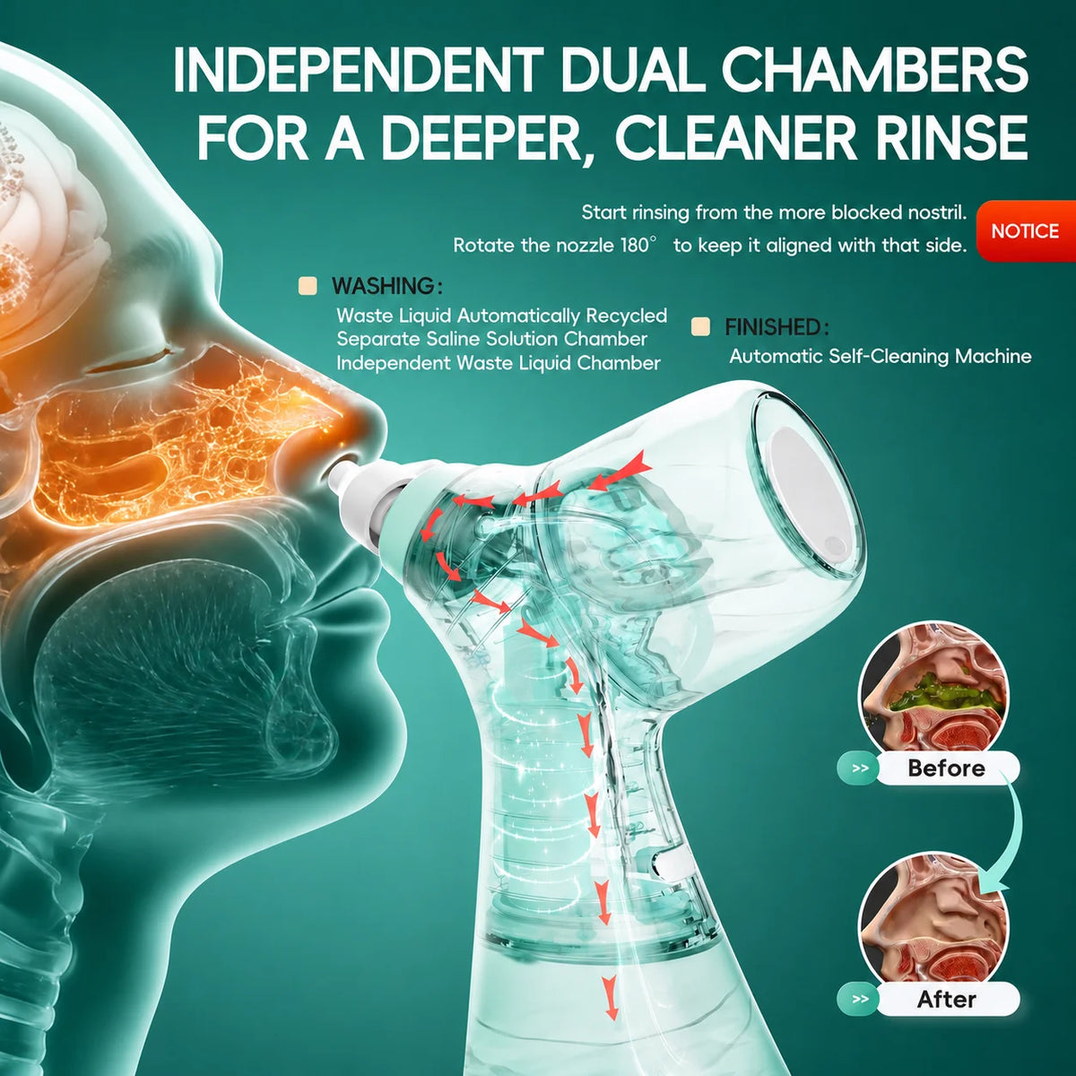 Nasal Irrigation System – Sinus Rinse Machine with Water and Waste Collection Tanks for Nasal Cleansing