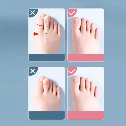 2Pc Silicone Toe Separator — Foot & Toe Spreader for Hallux Valgus, Bunion Correction & Toe Straightening