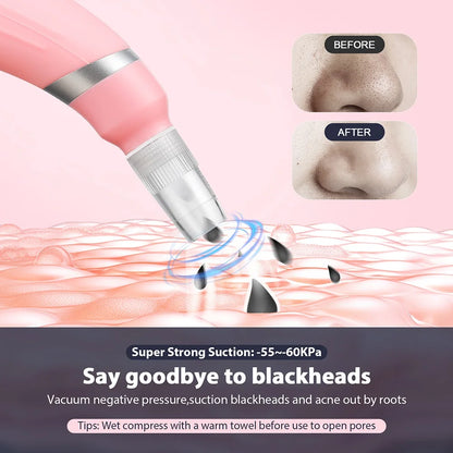 Professional Diamond Microdermabrasion Machine – At-Home Facial Peeling & Deep Cleaning Skin Care Tool