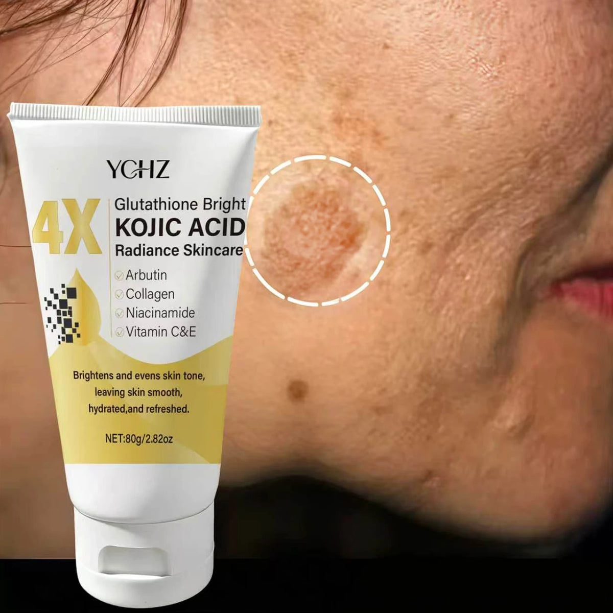Kojic Acid Face Cream - Dark Spot Corrector, Skin Tone Brightening & Moisturizing Day/Night Cream for Men & Women