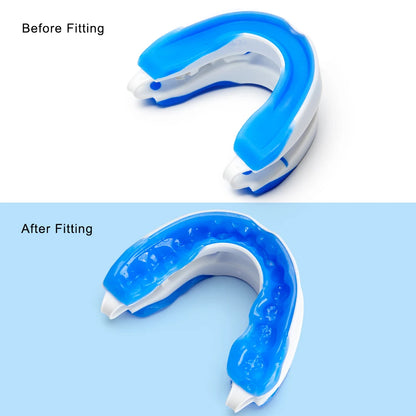 Silicone Anti-Snore Mouthpiece – Mouth Guard for Snoring, Bruxism, Sleep Apnea, and Teeth Protection
