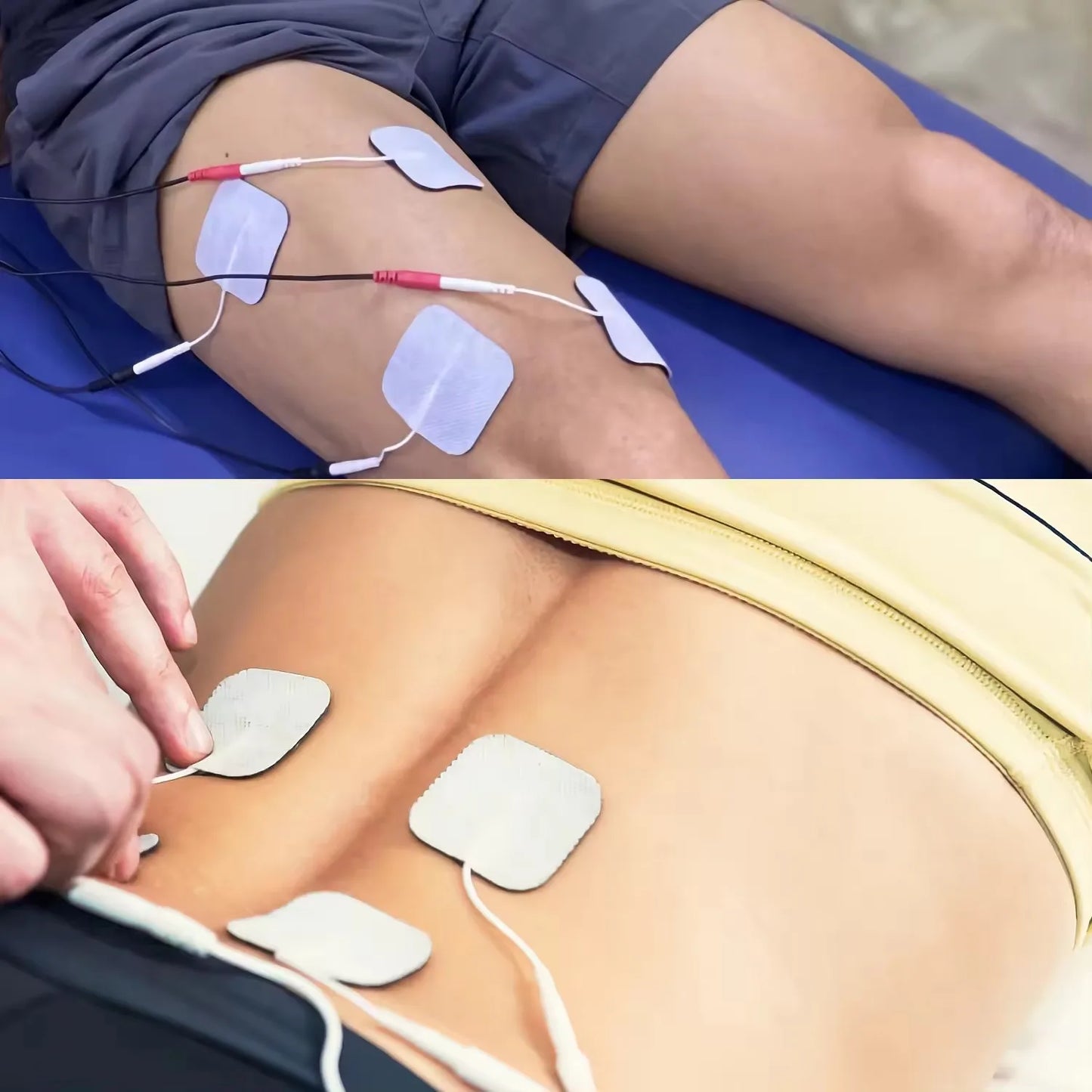 4-in-1 Electric Muscle Stimulator — EMS, IFT, RUSS & TENS High-Frequency Physiotherapy Device