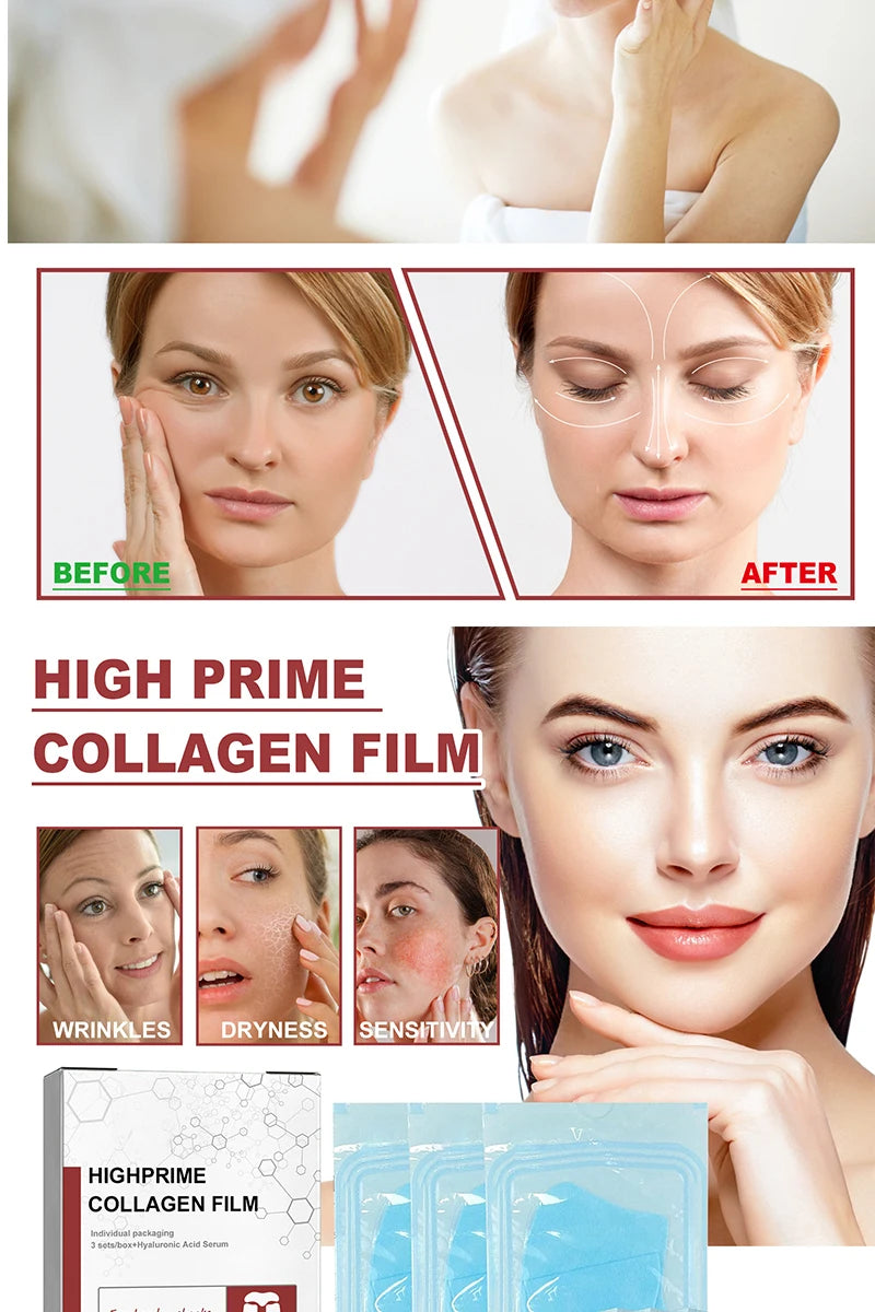 Collagen Membrane for Eye Rejuvenation – Lightens Wrinkles, Dark Circles & Bags, Firming & Moisturizing Skin
