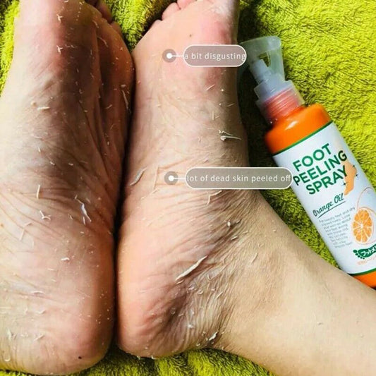 110ML Foot Exfoliating Gel - Cuticle Remover Dead Skin Softener Callus Removal Pedicure Foot Mask for Smooth Feet