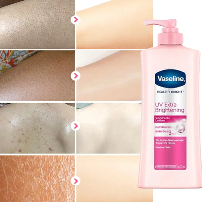 Whitening & Moisturizing Vaseline Body Lotion – Niacinamide Brightening Skin Lotion, 100ml/400ml Options