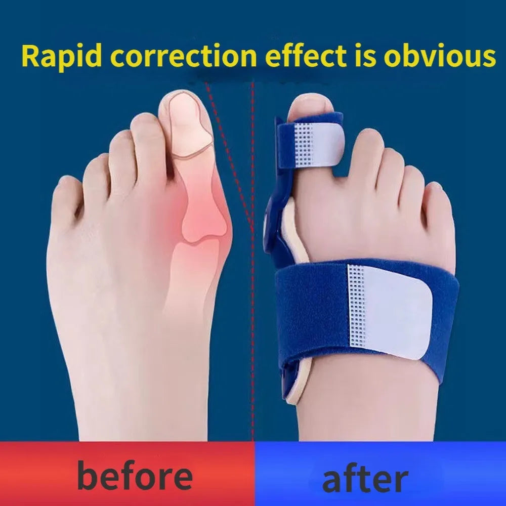 Big Bone Toe Bunion Splint - Foot Pain Relief Corrector and Hallux Valgus Protector for Feet Care - Available in 1PC or 2PCs