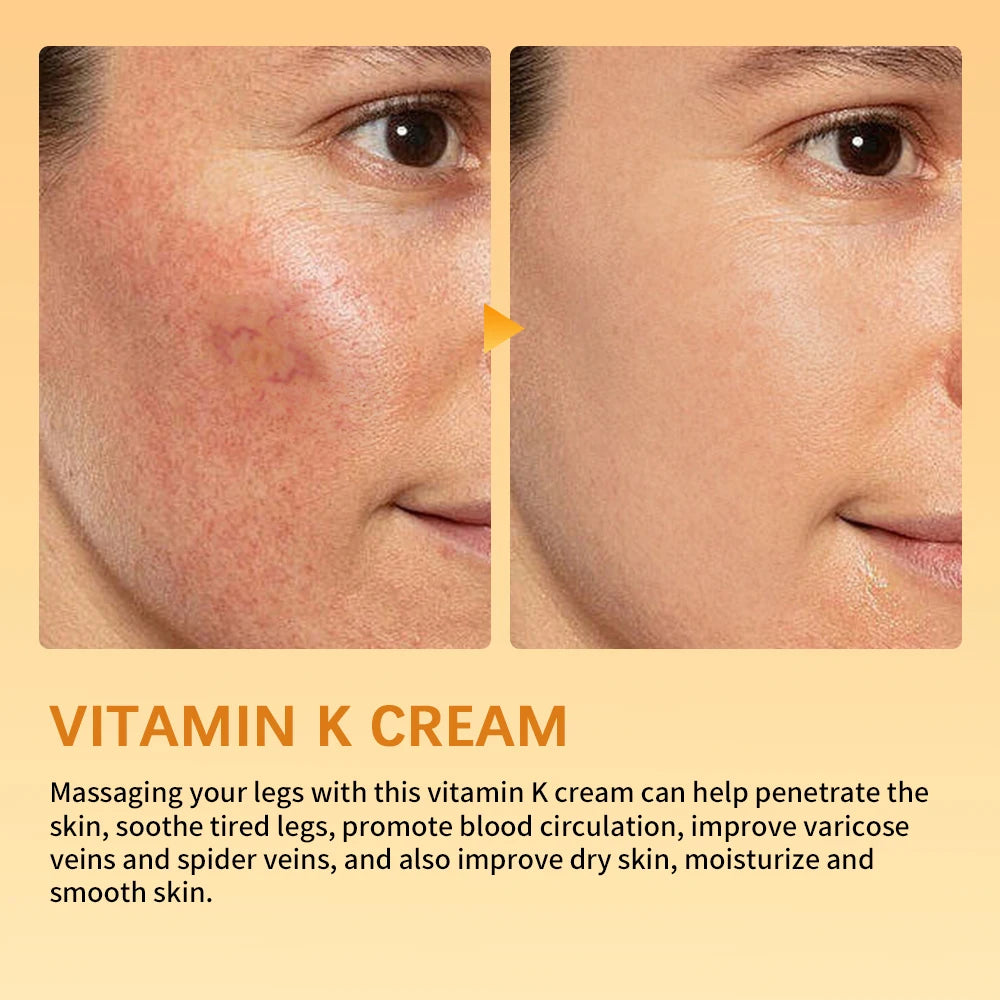 Vitamin K Leg Care Cream - Soothing Massage Cream for Tired Legs, Varicose Vein & Spider Vein Appearance Support