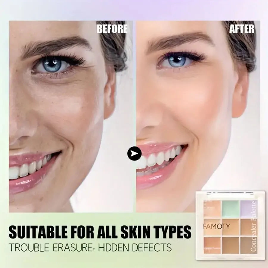 9 Color Flawless Concealer Palette – Waterproof, Sweatproof, Full Coverage for Spots, Acne, Dark Circles, Tear Grooves