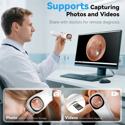 5-in-1 Smart Ear Camera with Screen – 1080P HD Earwax Removal Kit with Ear Picks, 6 Tips & 12 Extra Inspection Heads
