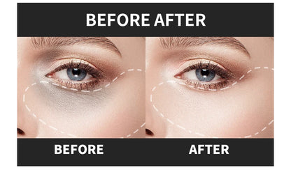 Micro-Needle Hyaluronic Acid Eye Patch – Anti-Wrinkle Moisturizing Eye Mask for Fine Lines Removal