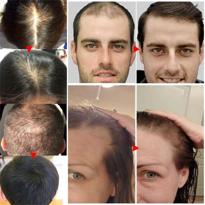 Ginger Hair Growth Serum Spray - Moisturizing Scalp Care and Nourishing Hair Treatment for Men and Women