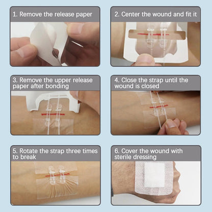 Camping Wound Closure Strips – Painless Adhesive Suture Patch for Fast Hemostatic Care & First Aid