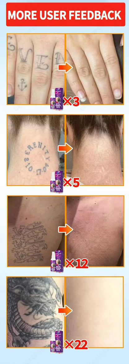 Tattoo Removal Spray — Fast-Acting Formula Removes Tattoos in 7 Days