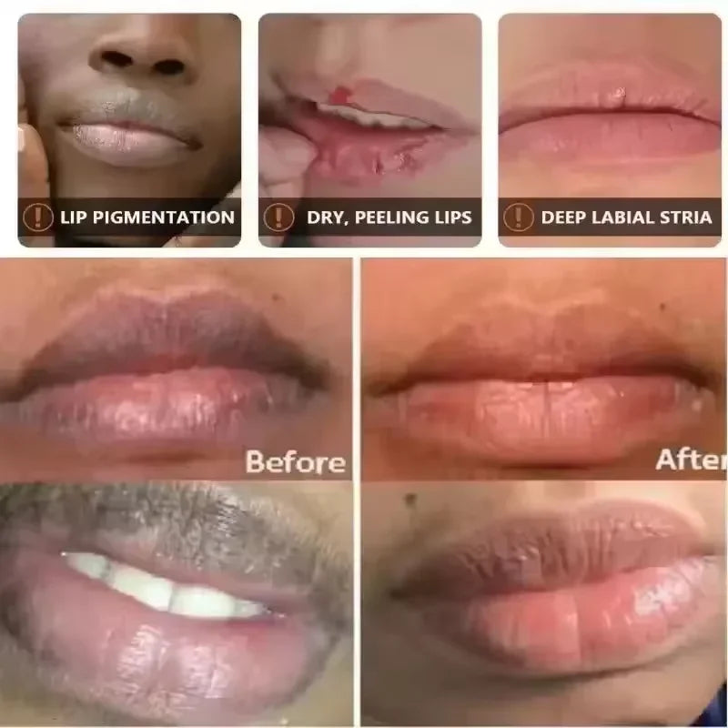 Lip Lightening & Repair Lip Mask Serum – Exfoliating Dark Lip Balm for Melanin Reduction, Hydration & Smooth Lip Care Treatment