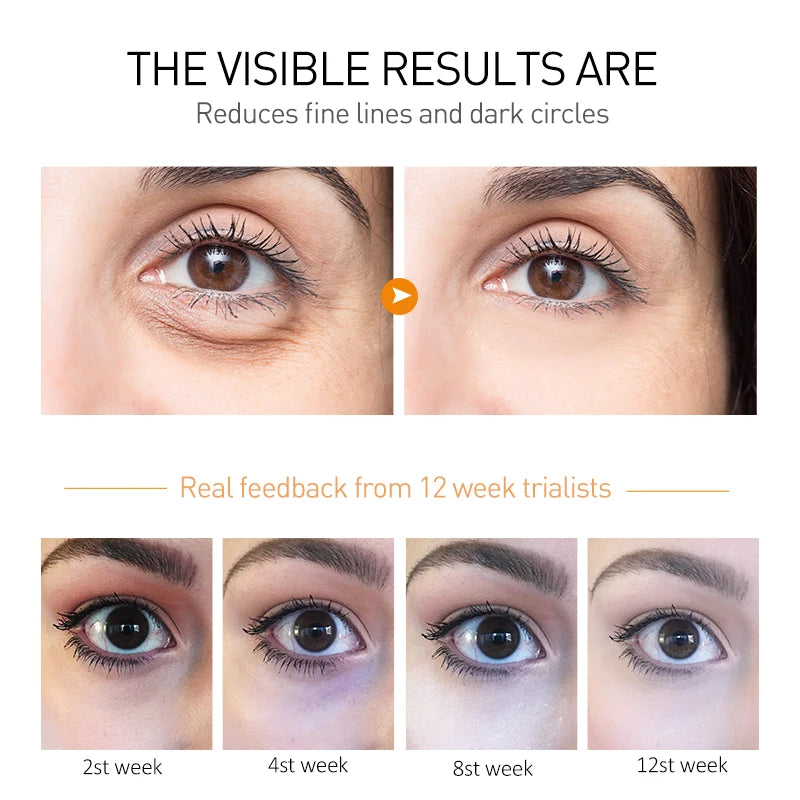 OCHEAL Eye Moisturizing Cream – Anti-Aging Serum for Dark Circles, Fine Lines, Puffiness, and Firmness