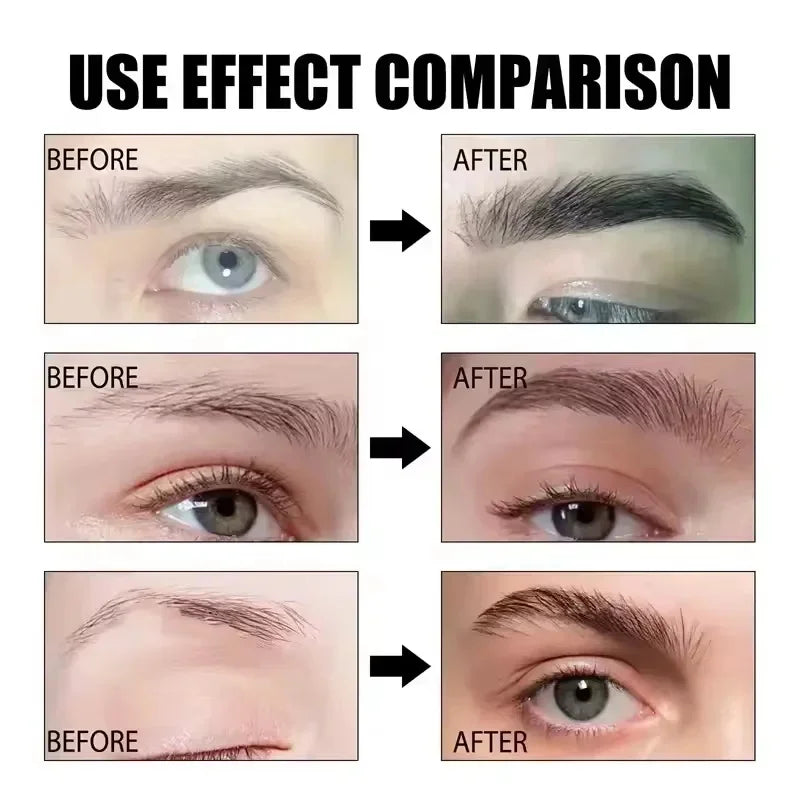 Fast Eyebrow & Eyelash Growth Serum – Hair Loss Prevention, Thicker Fuller Brows & Lashes Enhancer