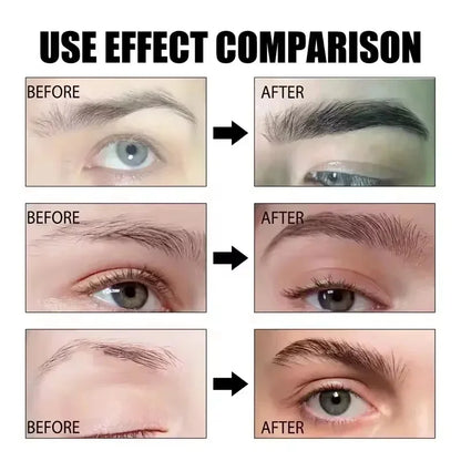 Fast Eyebrow & Eyelash Growth Serum – Hair Loss Prevention, Thicker Fuller Brows & Lashes Enhancer