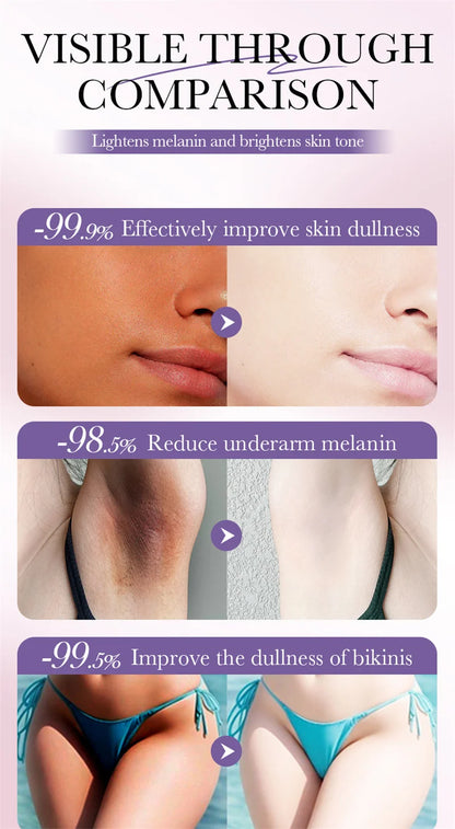 Whitening Cream for Private Parts – Underarm, Inner Thigh & Knee Brightening Serum
