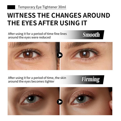 Instant Firming Eye Cream – Wrinkle-Smoothing & Tightening Moisturizer for Under-Eye Bags, Fine Lines & Pores