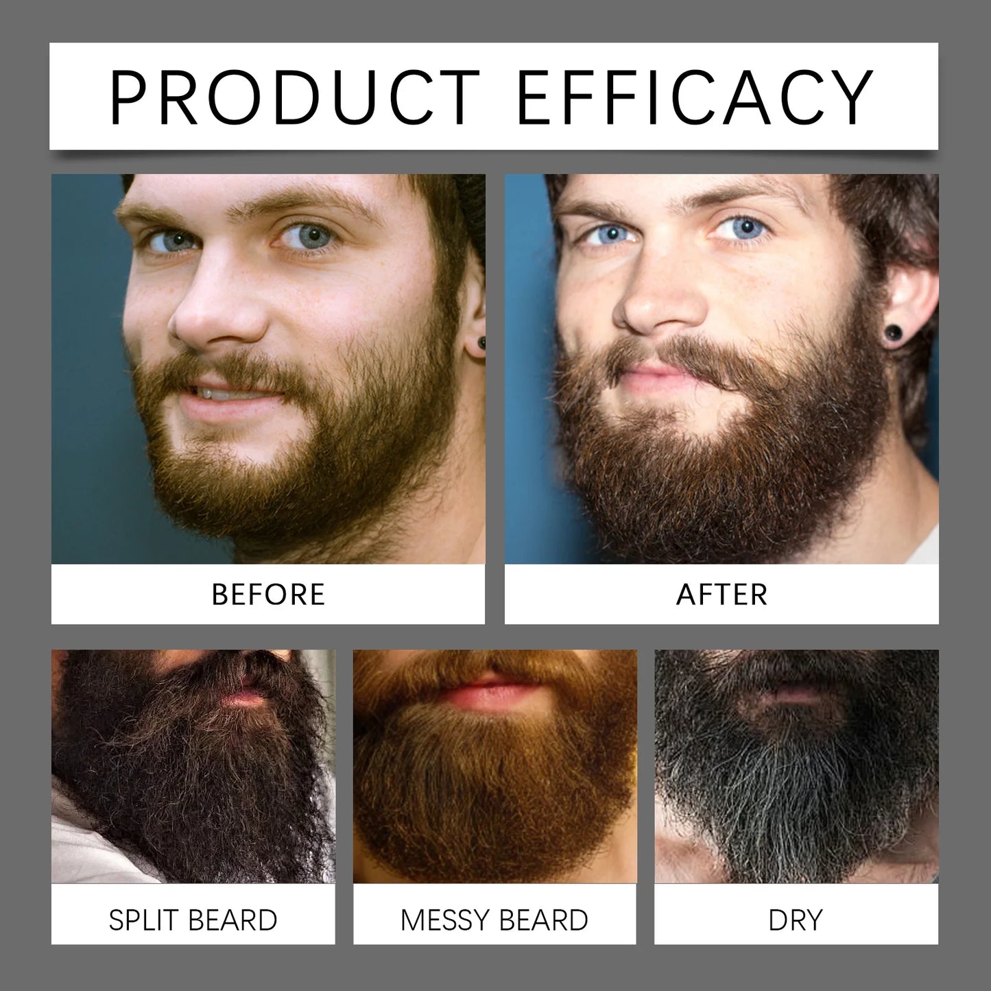 East Moon Beard Growth Serum Set – Hair & Whisker Growth Oil for Strengthening Roots, Moisturizing Skin & Softening Beard Care Hydration Treatment