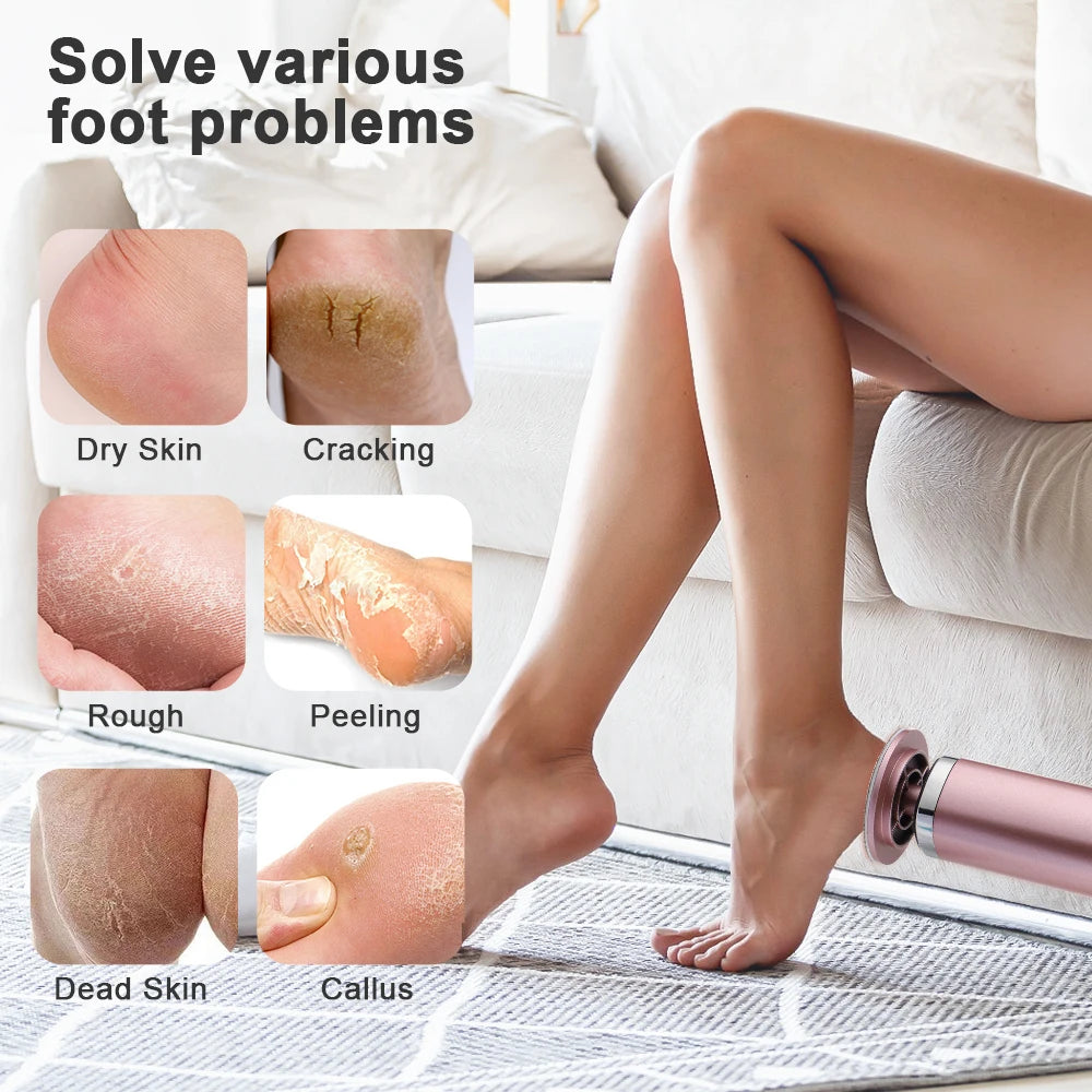 Rechargeable Wireless Electric Foot Callus Remover — Pedicure Tool for Dead Skin & Cuticle Removal (Replacement Sanding Heads)